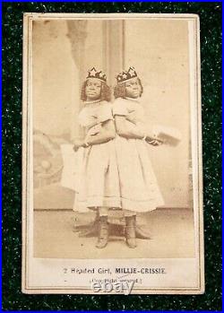 Civil War Era African American CDV Photo Freak Show Twins Two Headed Girl